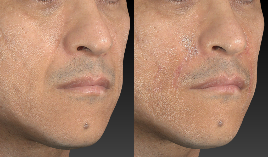 TRATAMENTO DE BIGODE CHINES